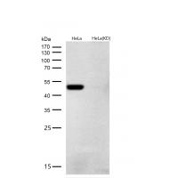 ARRB1 Rabbit mAb