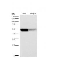 Cytokeratin 7 Rabbit mAb  