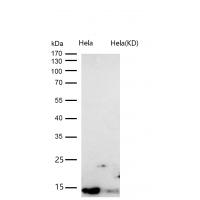 DYNLL1 Rabbit mAb