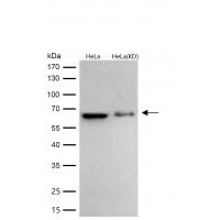 IRAK3 Rabbit mAb