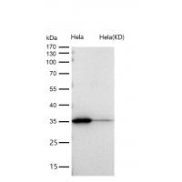 Annexin A10 Rabbit mAb