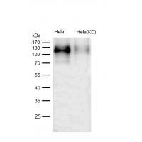 CD36 Rabbit mAb