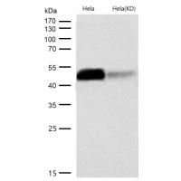 PAX6 Rabbit mAb