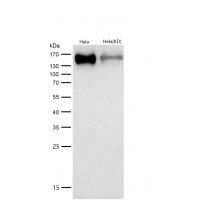 HDAC4 Rabbit mAb