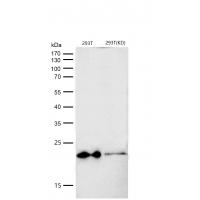 HSPB8/HSP22 Rabbit mAb