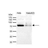 Cdc16/APC6 Rabbit mAb