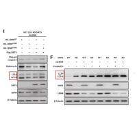 LC3B Rabbit mAb