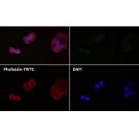 LC3B Rabbit mAb