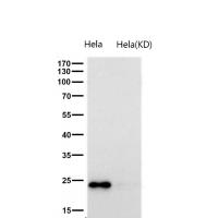 GPX1 Rabbit mAb