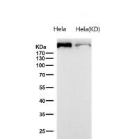 FASN Rabbit mAb