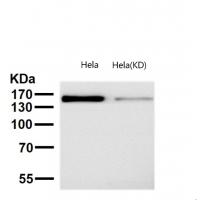 Drosha Rabbit mAb