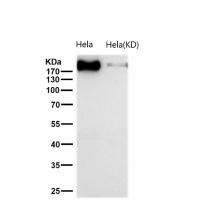 GCN2 Rabbit mAb