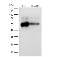 LOXL2 Rabbit mAb 