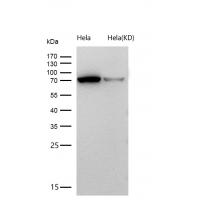 Fructose 6 Phosphate Kinase Rabbit mAb