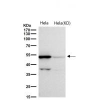 PIST Rabbit mAb