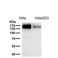 Desmoglein 2 Rabbit mAb