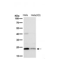 GLO1 Rabbit mAb