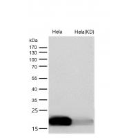 NM23 Rabbit mAb