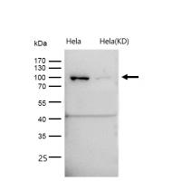 TRAF6BP Rabbit mAb