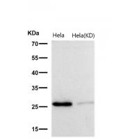 GCLM Rabbit mAb