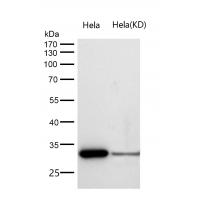 TSFM Rabbit mAb