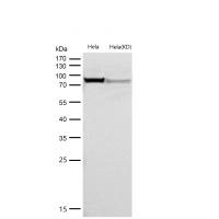 PRMT7 Rabbit mAb