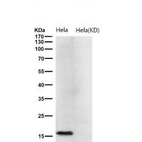 TCEB2 Rabbit mAb