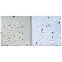 CLK2 Polyclonal Antibody