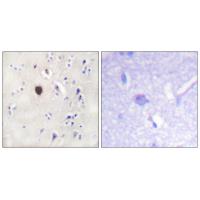 KIR6.2 Polyclonal Antibody