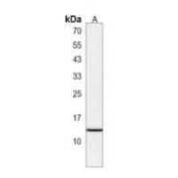 Anti-VKORC1 Antibody