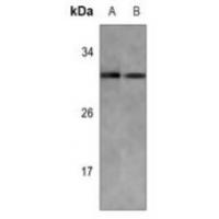 KDELR3 Antibody