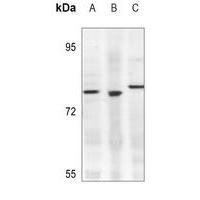 KLHL3 Antibody