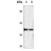 NT5C3 Antibody