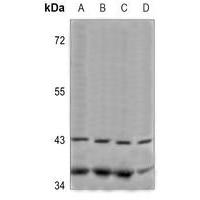 PABPC5 Antibody