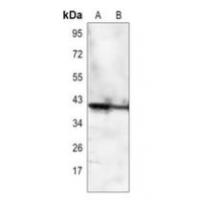 CD32c Antibody