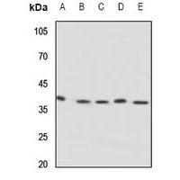 KCNAB3 Antibody