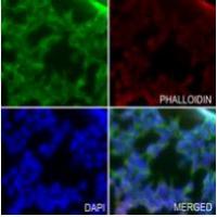 KCNAB3 Antibody