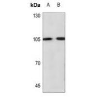 ADAMTS1 Antibody