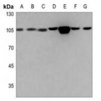 ACTN1/2/3/4 Antibody