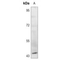 GPR143 Antibody