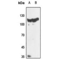 Histone Deacetylase 5/9 Antibody