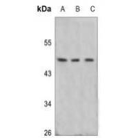 POTEA Antibody