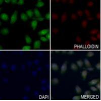 MTA1 Antibody