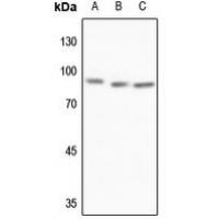 MTA1 Antibody