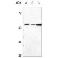 ULK3 Antibody