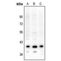 PAR4 Antibody