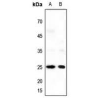 Neuromedin U Antibody