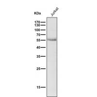 Wilms Tumor Protein Rabbit mAb