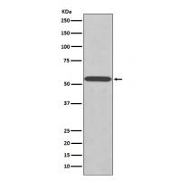 Wilms Tumor Protein Rabbit mAb