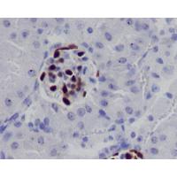 Wilms Tumor Protein Rabbit mAb